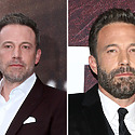 Has Ben Affleck Had A Hair Transplant?