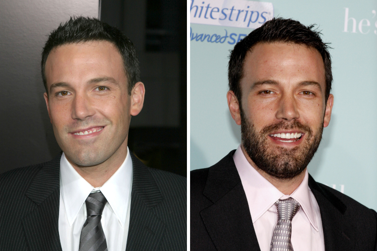 Ben Affleck early hair