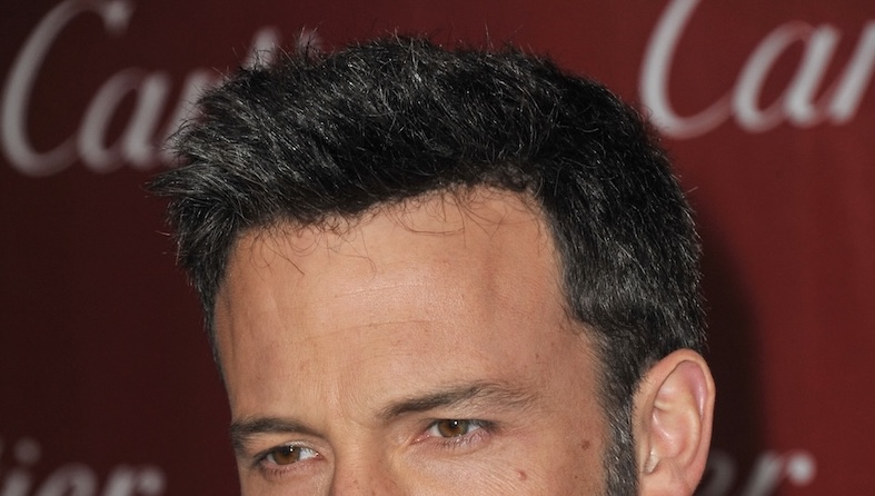 ben affleck hair system hairline closeup