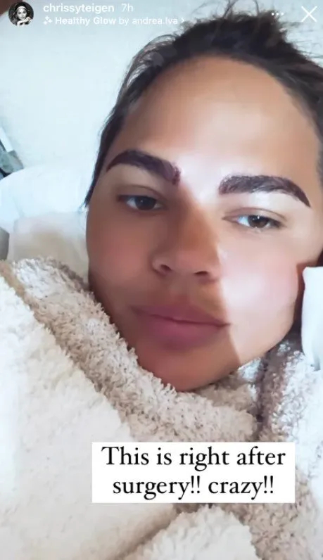 chrissy teigen instagram story