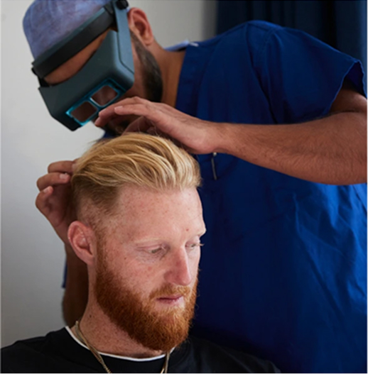 Beard Transplant, Wimpole Clinic