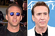 Hair Transplant