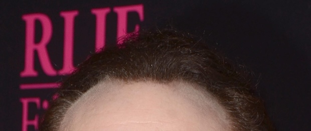 Close up of Nicolas Cage&rsquo;s hairline (2018)