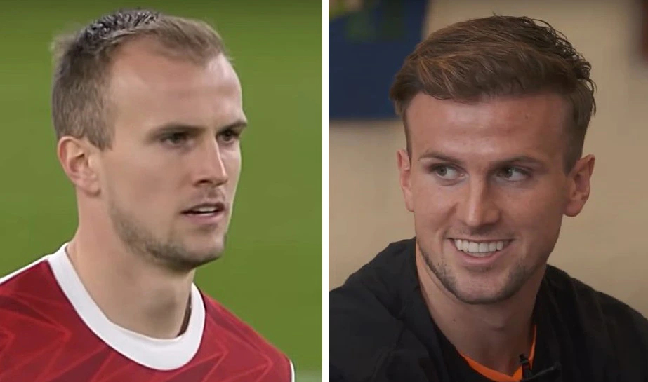 rob holding before and after hair transplant