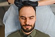 Hair Loss