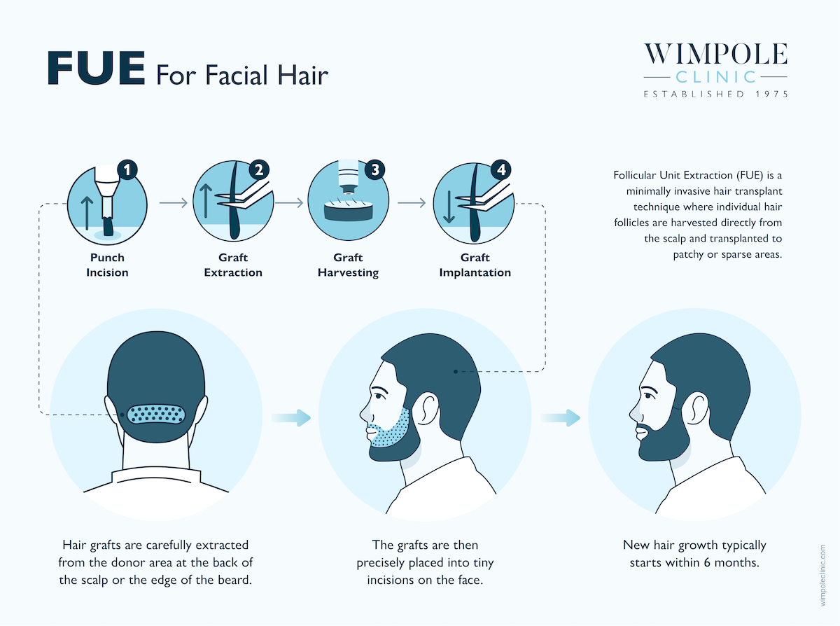FUE For Facial Hair