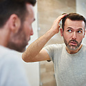 Do Hair Transplants Work?