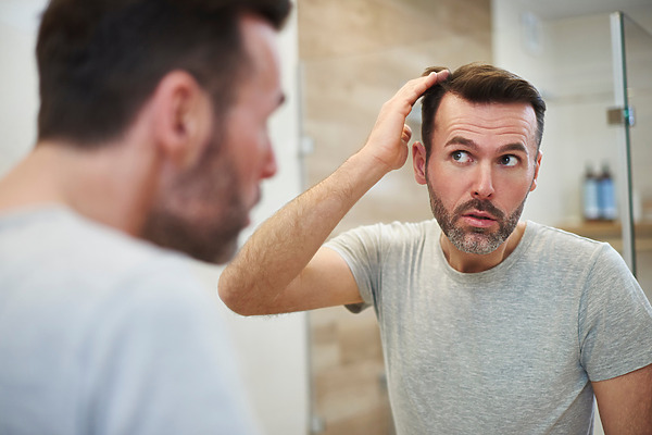 Hair Transplant Shedding: Everything You Need To Know, Wimpole Clinic
