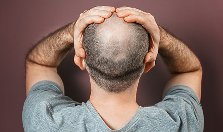 How To Regrow Hair On Bald Spot Fast Featured Image