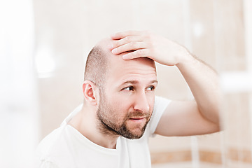 latest research male pattern baldness