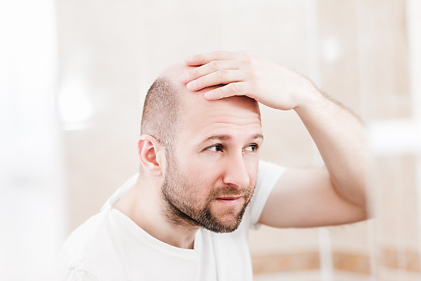 Why is Hair Loss More Common in Men than Women?, Wimpole Clinic