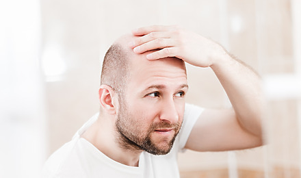 Baldness Cure Featured Image