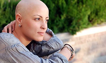 Chemotherapy-hair-loss-special-cancer