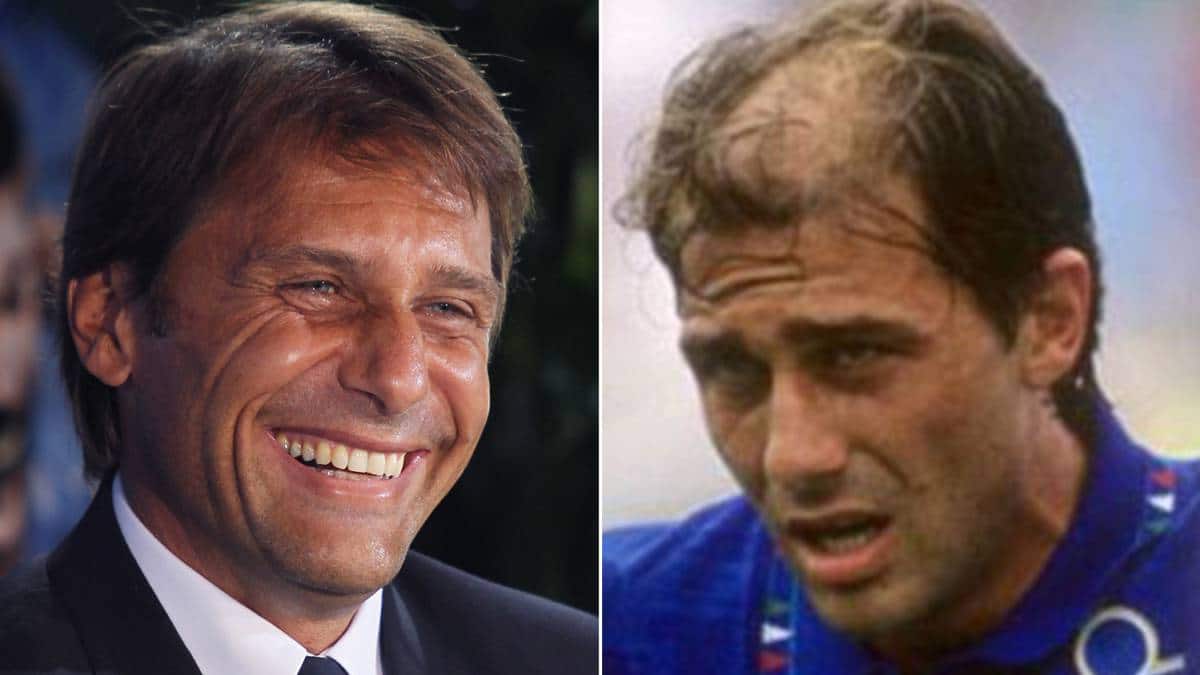 Antonio Conte wig