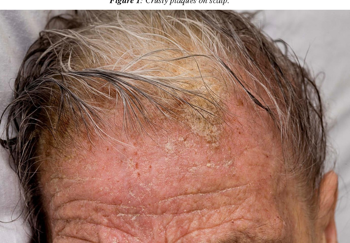 23 Causes Of An Itchy Scalp, According To The NHS