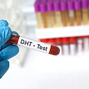 What Is DHT & Its Role In Hair Loss? A Complete Overview