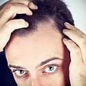 Why Is Hair Loss More Common In Men Than Women?