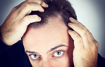 Why is Hair Loss More Common in Men than Women?