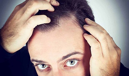 3-hair-loss-symptoms-you-shouldn't-ignore