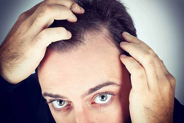 3-hair-loss-symptoms-you-shouldn't-ignore