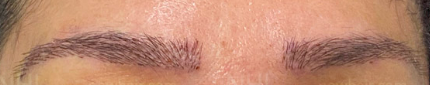 1 week posr eyebrow restoration