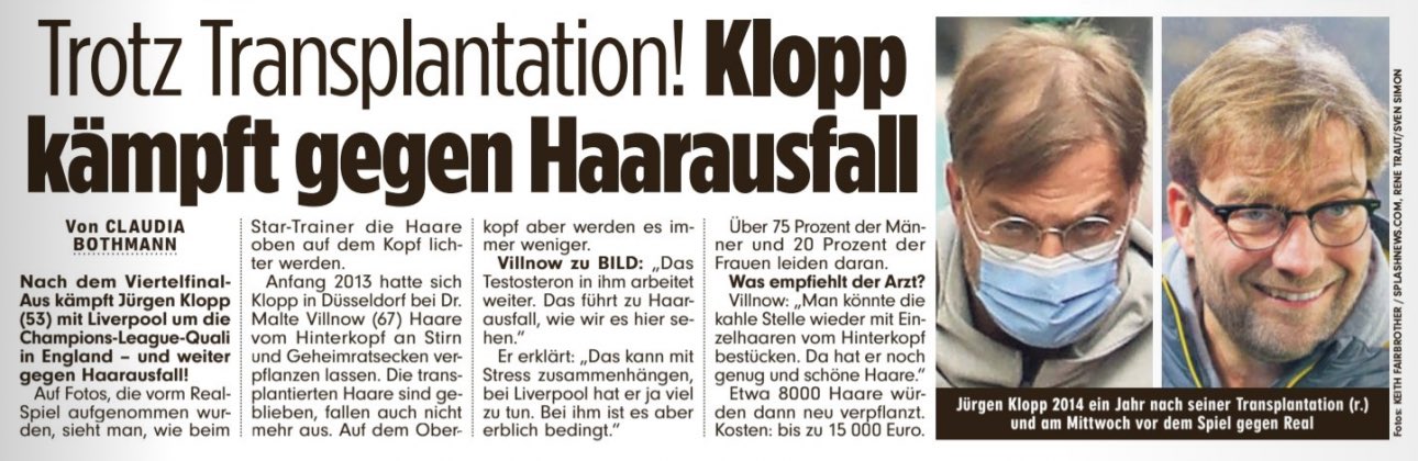 German newspaper article reporting on Klopp's hair loss