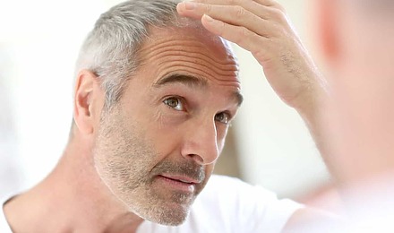 Senior Man And Hair Loss Issue
