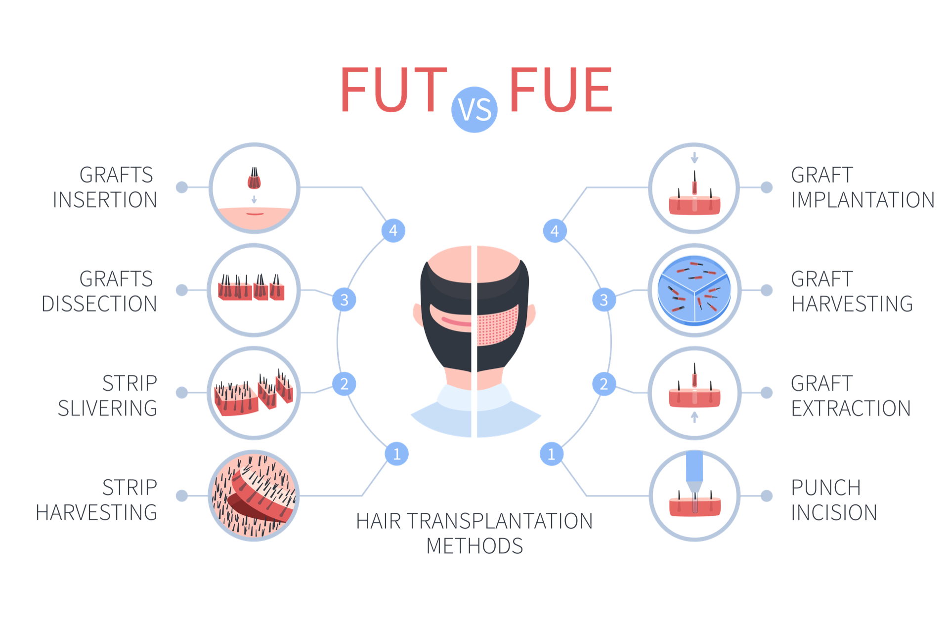 The difference between FUT and FUE hair transplant