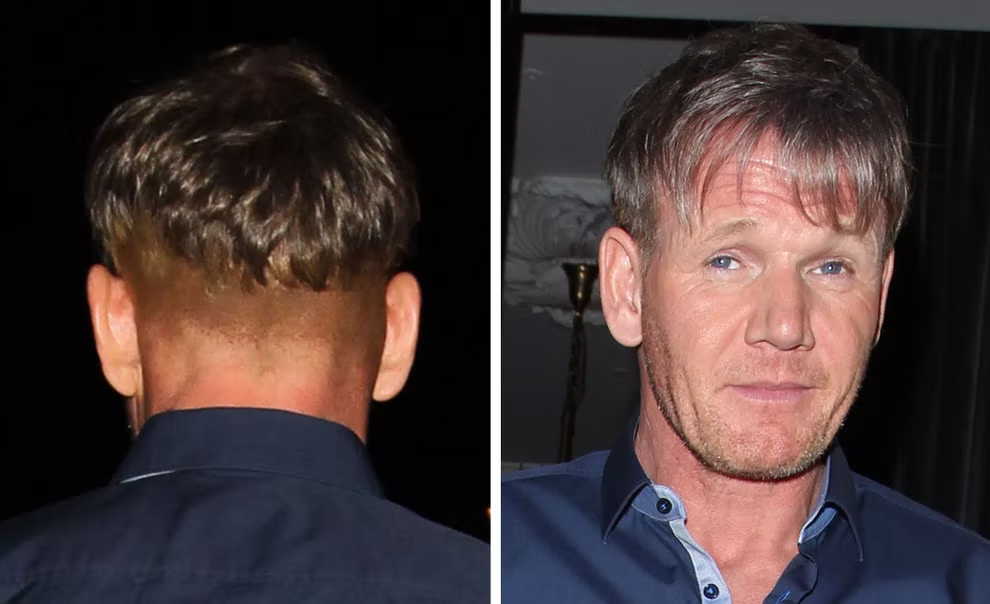 Gordon Ramsay back (hair shaven) and front picture
