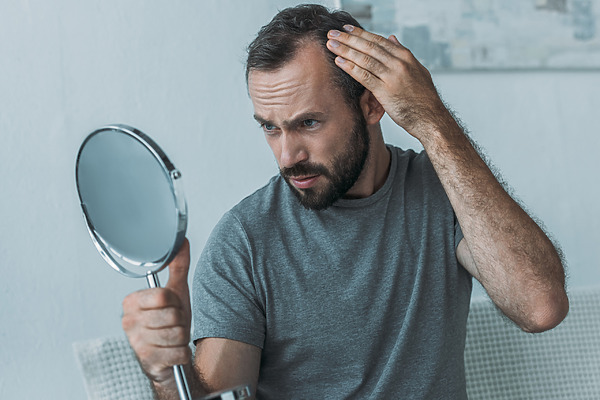 Man Looking At His Hairline