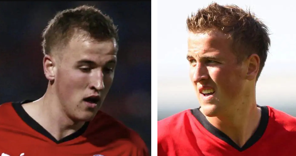 Young Harry Kane showing early signs of a male pattern baldness