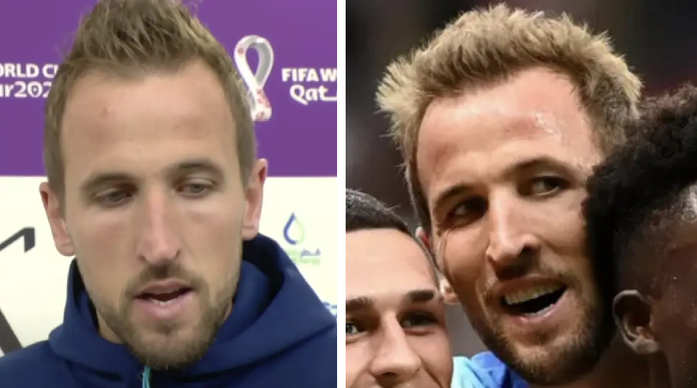 Harry Kane's thicker hair at the World Cup