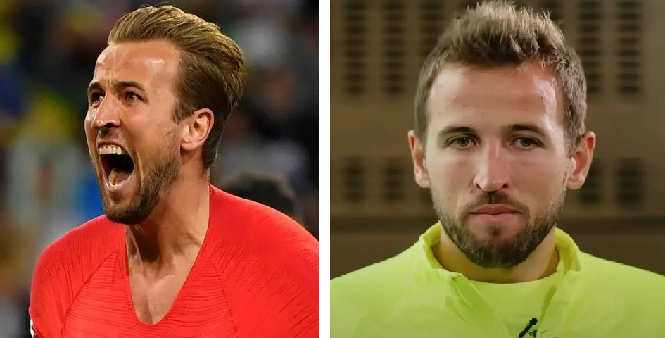 Harry Kane's change in hairline throughout the years