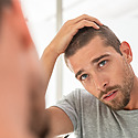 7 Ways To Tell Your Hairline Is Receding And The Best Treatments