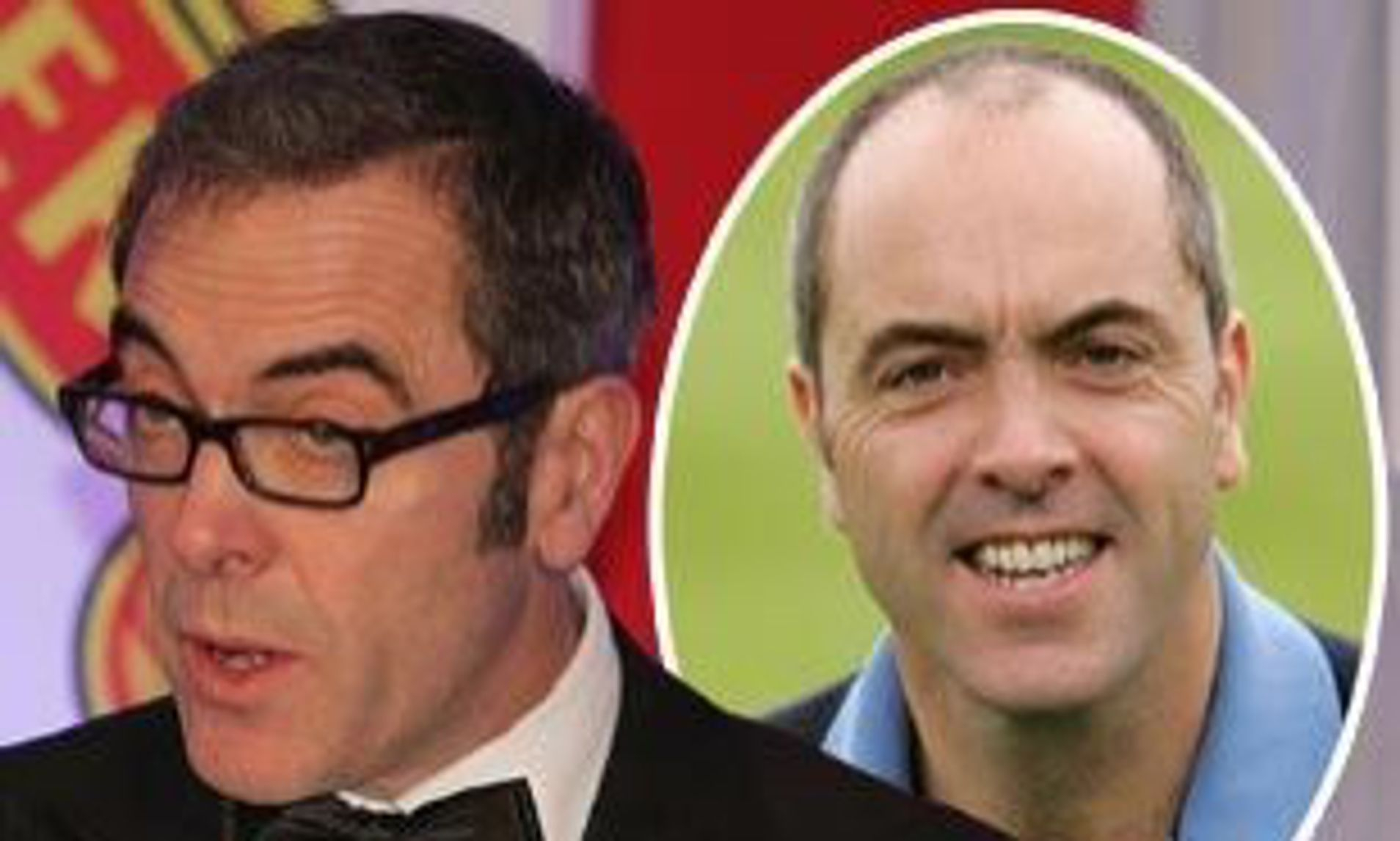 James Nesbitt before and after hair transplant photo