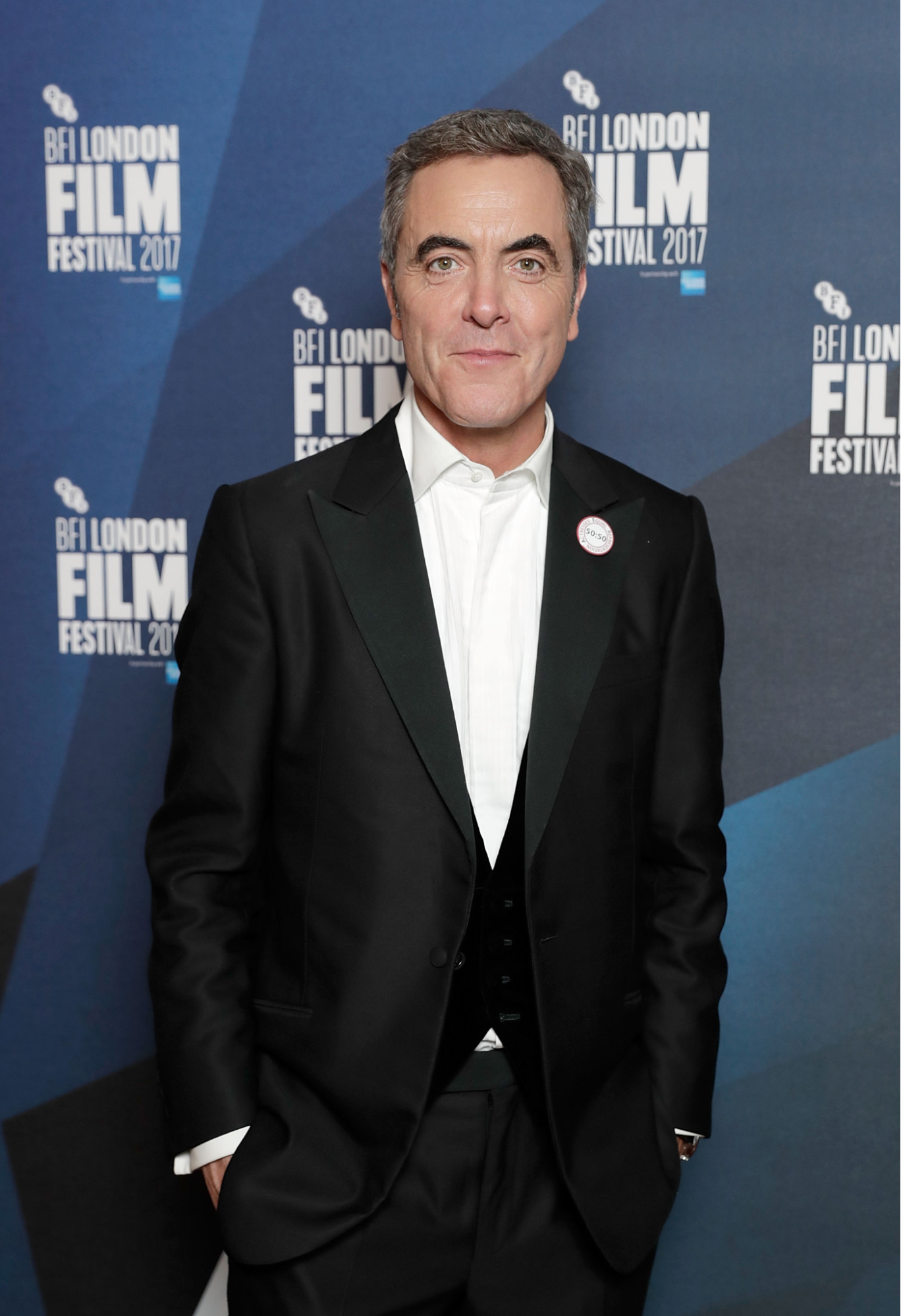 James Nesbitt Hair Transplant: Everything You Need to Know, Wimpole Clinic