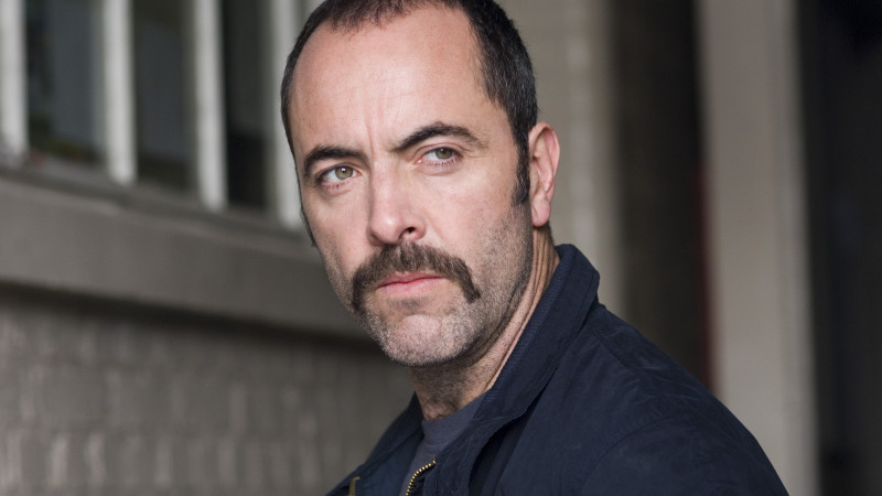 James Nesbitt after his hair loss pattern changed his hairline