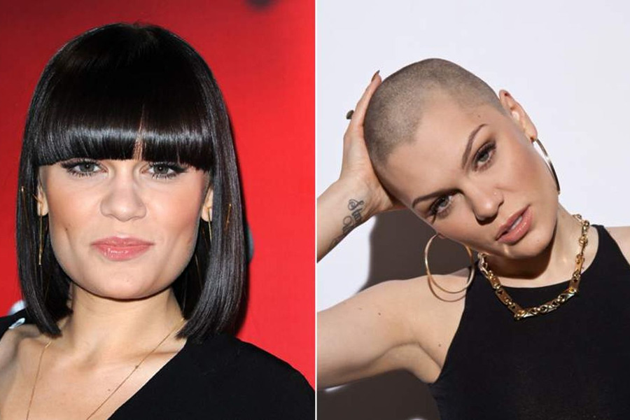 Jessie J With Hair And Bald