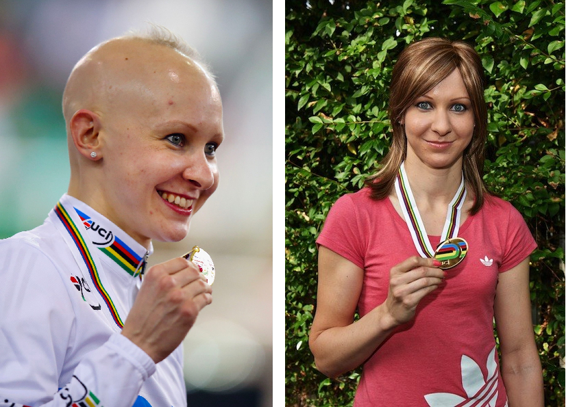 Joanna Rowsell bald and with hair