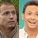 Joe Swash Hair Transplant: Everything You Need To Know