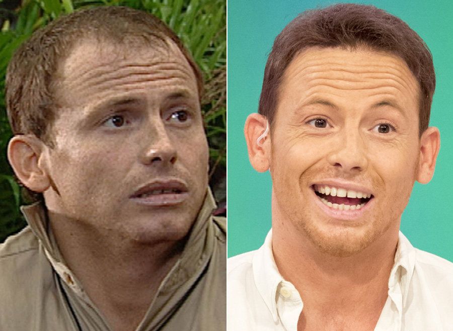 Joe Swash Hair Transplant Everything You Need to Know Wimpole