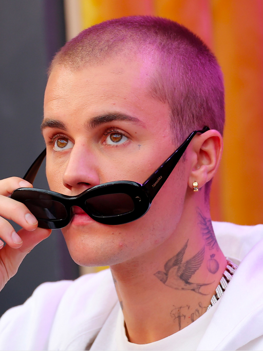 Justin Bieber Hair Loss Everything You Need To Know Wimpole Clinic