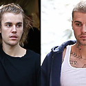 Justin Bieber Hair Loss: Everything You Need To Know