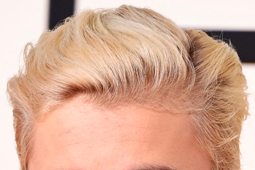 Justin Bieber bleach blonde hairline