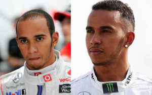 Lewis Hamilton hairline from 2012-2015