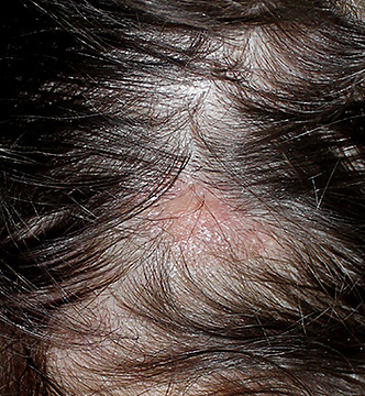 23 Causes Of An Itchy Scalp, According To The NHS