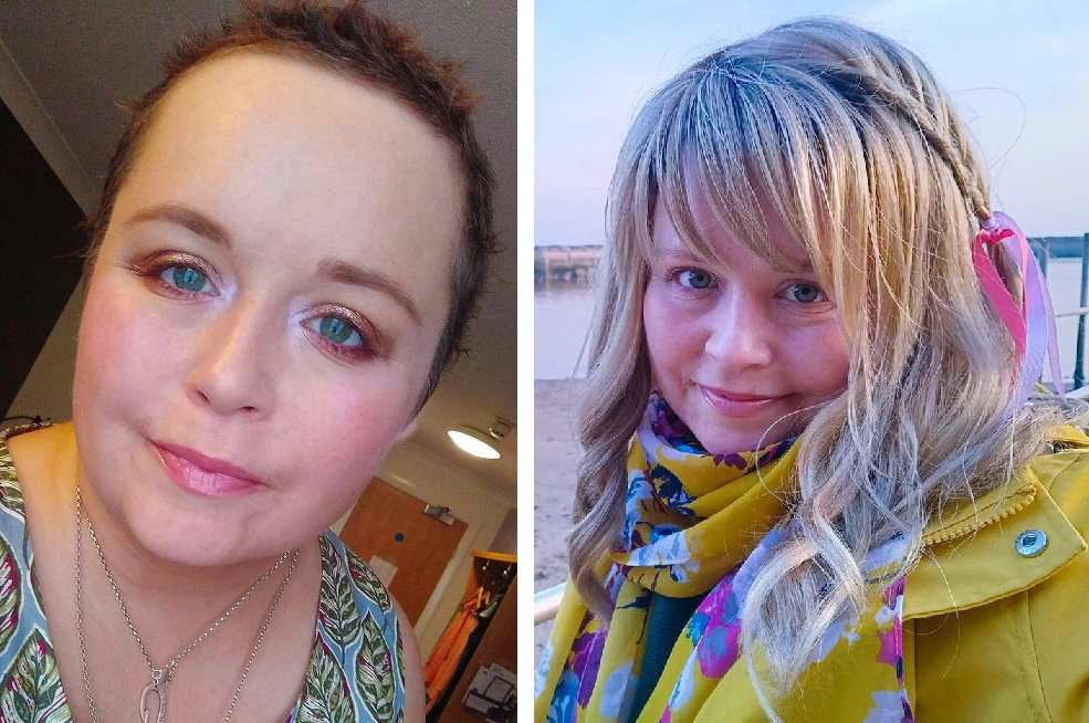Following chemotherapy treatment (left) and wearing a wig (right).
