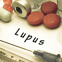 Lupus And Hair Loss: Causes, Symptoms, Diagnosis & Treatment