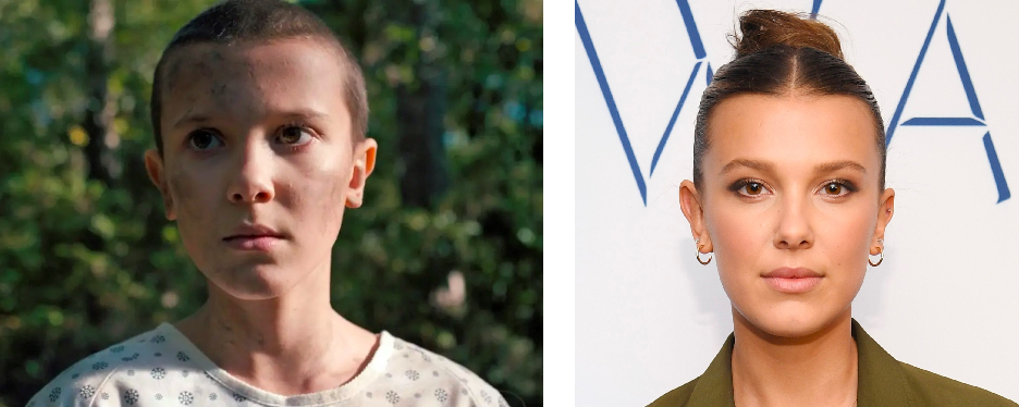29 Bold Bald Women Who Rocked A Shaved Head, Wimpole Clinic