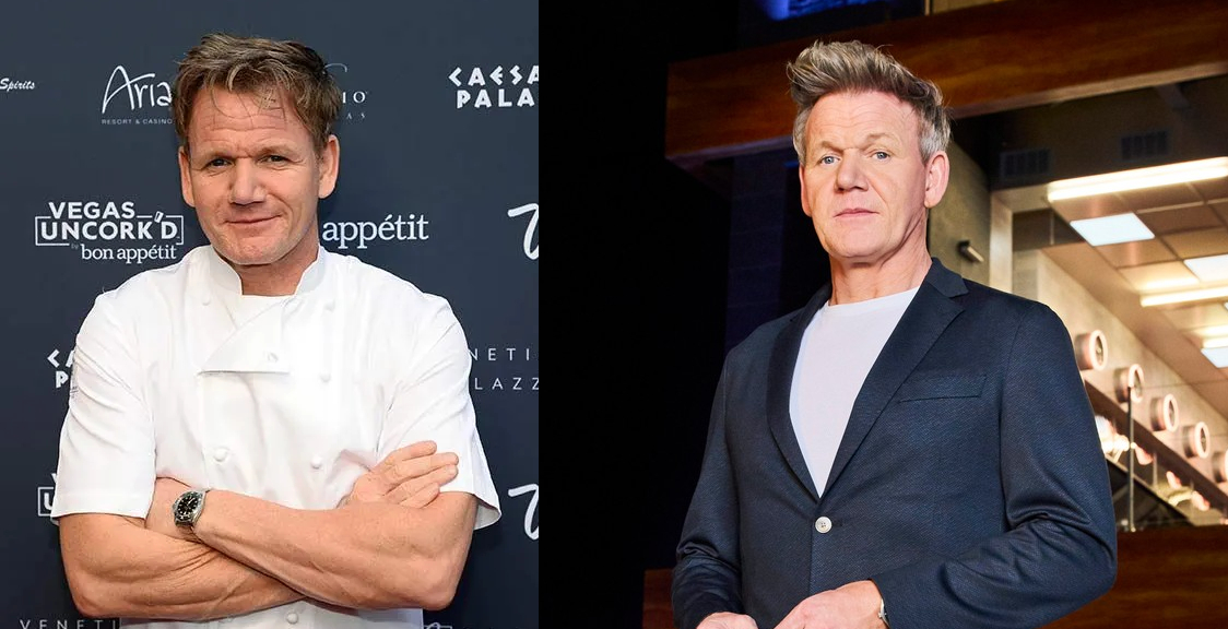 Gordon Ramsay Hair Transplant: Everything You Need To Know, Wimpole Clinic